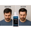 L`ROUGE - Kepeğe Karşı Çift Etkili Şampuan 200 ml